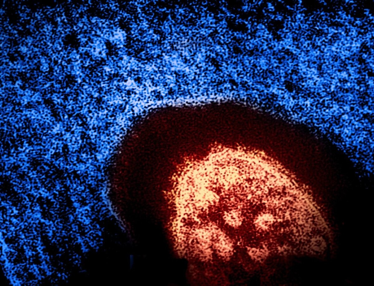 Measles virus